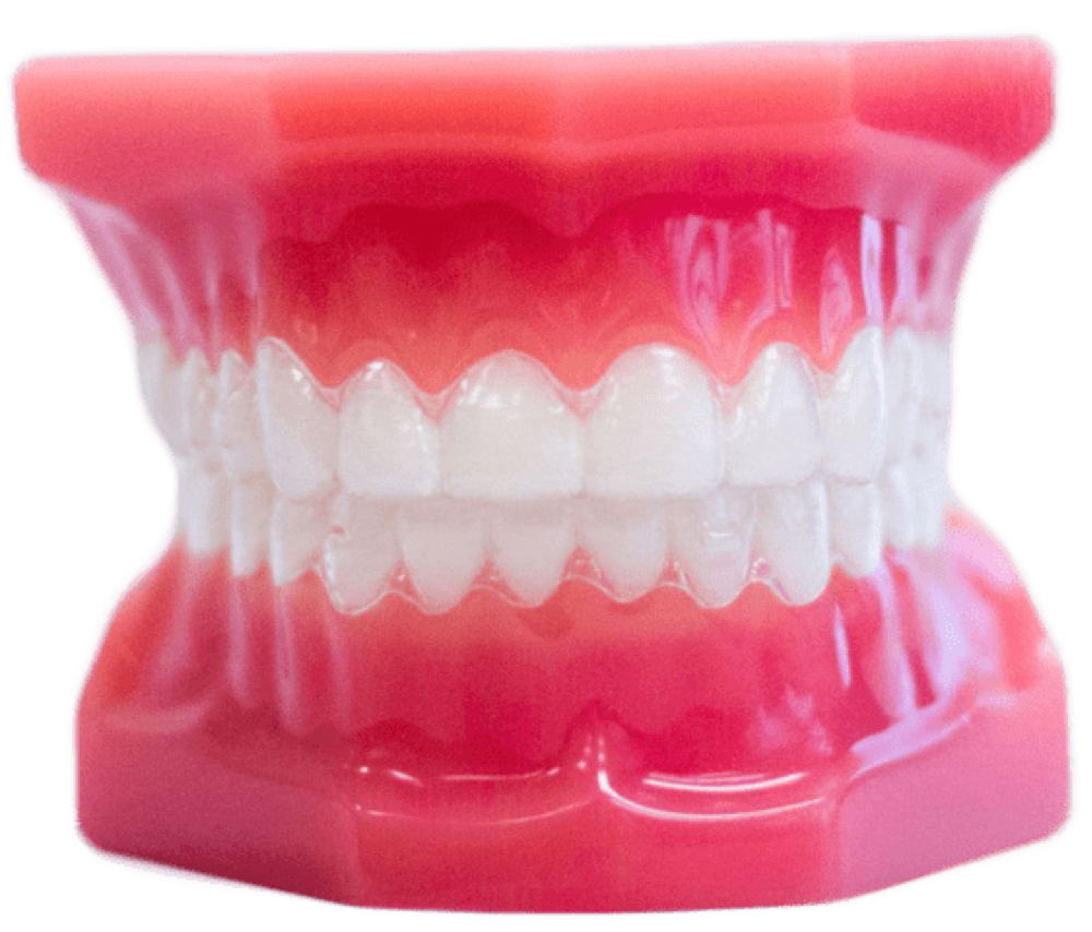 clear aligners on plastic model